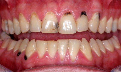 Olhe para seus dentes para descobrir sobre sua saúde! Problemas nos dentes