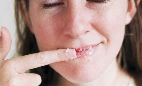 Use óleos vegetais naturais para tratar seus lábios ressecados eficientemente! Cuidados com os lábios ressecados