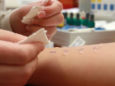 Teste para alergia