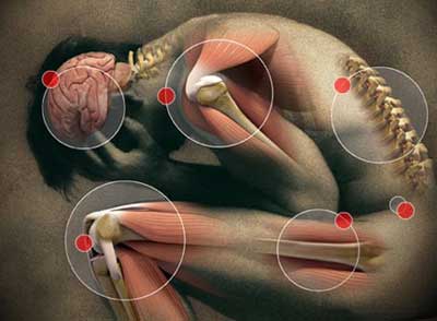 Resultado de imagem para dores musculares