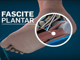 O que causa dores nos pés?