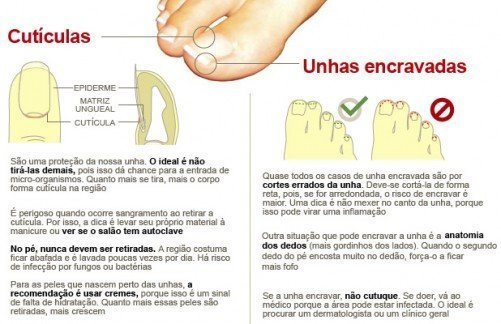 Prevenção das unhas encravadas