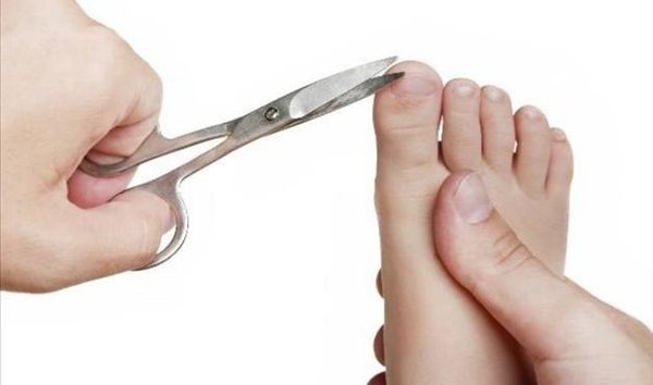 Como prevenir machucado nas unhas?