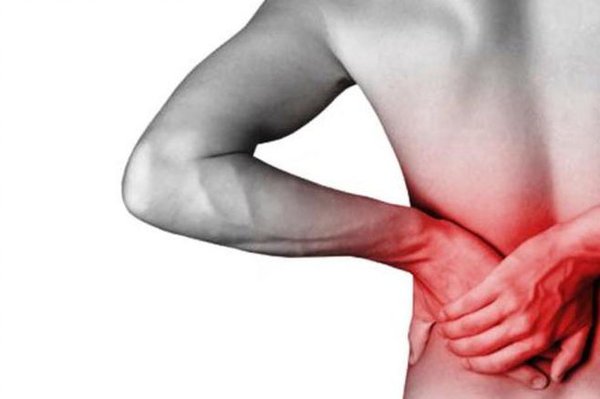 Quem tem hérnia de disco pode fazer musculação?