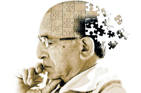 Tratamentos para o Alzheimer