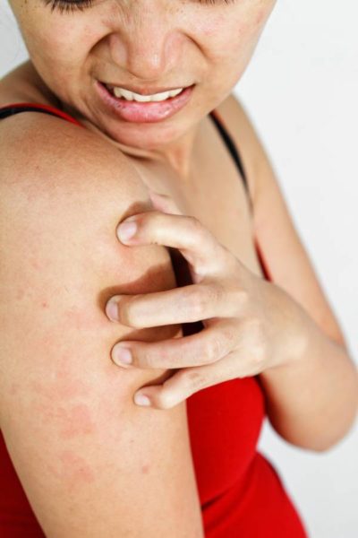 Problemas de pele musculação