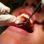 Com qual frequência devemos ir ao dentista?