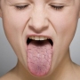 7 formas de melhorar a boca ressecada!