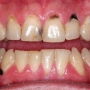 Problemas nos dentes? Podem ser sintomas de algo mais grave!
