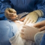 Cirurgia para hérnia de disco vale a pena? Um caso real!
