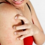 8 problemas de pele causados pela musculação!
