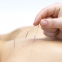 Como é uma sessão de acupuntura? Dói? Quais os riscos?