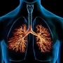 4 remédios caseiros para bronquite
